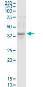 TMEM49 Antibody in Western Blot (WB)