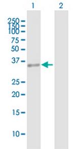 HLRC1 Antibody in Western Blot (WB)