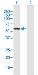 CCM2 Antibody in Western Blot (WB)