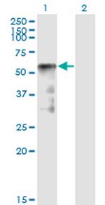 SESN2 Antibody in Western Blot (WB)