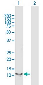 RBP5 Antibody in Western Blot (WB)