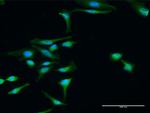 DTNBP1 Antibody in Immunocytochemistry (ICC/IF)