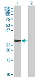 KIRREL2 Antibody in Western Blot (WB)