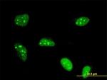 POLR1B Antibody in Immunocytochemistry (ICC/IF)