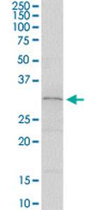 SLA2 Antibody in Western Blot (WB)