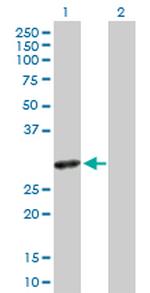 SLA2 Antibody in Western Blot (WB)