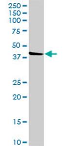 FLJ23356 Antibody in Western Blot (WB)