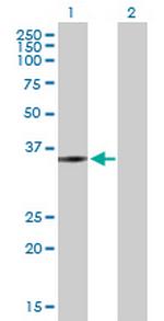 ZMYND12 Antibody in Western Blot (WB)