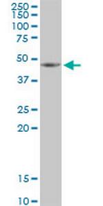 HSDL2 Antibody in Western Blot (WB)