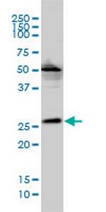 MGC10540 Antibody in Western Blot (WB)