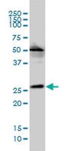 VPS25 Antibody in Western Blot (WB)