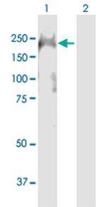 BTBD12 Antibody in Western Blot (WB)