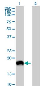 MAP1LC3A Antibody in Western Blot (WB)