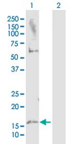 MAP1LC3A Antibody in Western Blot (WB)