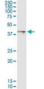 DGAT2 Antibody in Western Blot (WB)