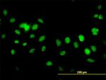 FBXL10 Antibody in Immunocytochemistry (ICC/IF)