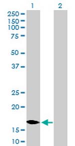 MCEE Antibody in Western Blot (WB)