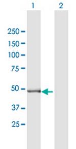 GPT2 Antibody in Western Blot (WB)