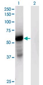 GPT2 Antibody in Western Blot (WB)