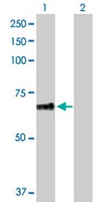 PLEKHA8 Antibody in Western Blot (WB)