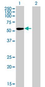 IGSF21 Antibody in Western Blot (WB)