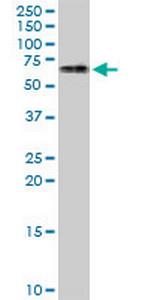 ATCAY Antibody in Western Blot (WB)