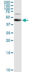 ALG2 Antibody in Western Blot (WB)