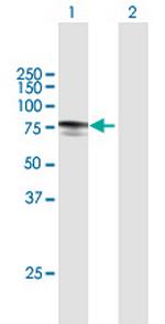 MYLK2 Antibody in Western Blot (WB)