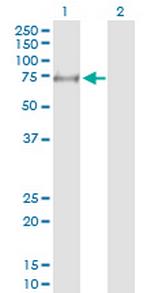 MYLK2 Antibody in Western Blot (WB)