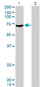 MYLK2 Antibody in Western Blot (WB)