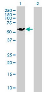 DIXDC1 Antibody in Western Blot (WB)