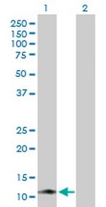 KIR3DX1 Antibody in Western Blot (WB)