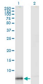 KIR3DX1 Antibody in Western Blot (WB)