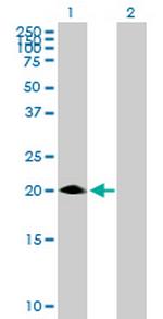 MED30 Antibody in Western Blot (WB)