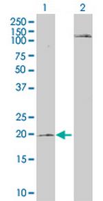 MCFD2 Antibody in Western Blot (WB)