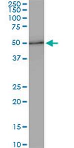 ZNF622 Antibody in Western Blot (WB)