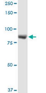 LRSAM1 Antibody in Western Blot (WB)