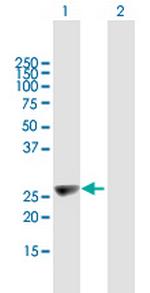 KIFC2 Antibody in Western Blot (WB)