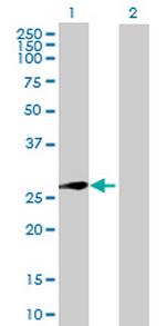 XRCC6BP1 Antibody in Western Blot (WB)