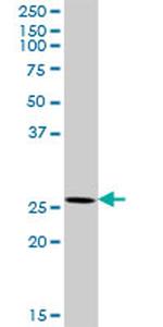 XRCC6BP1 Antibody in Western Blot (WB)