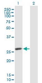 IDI2 Antibody in Western Blot (WB)