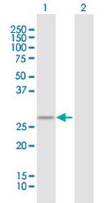 TMEM129 Antibody in Western Blot (WB)