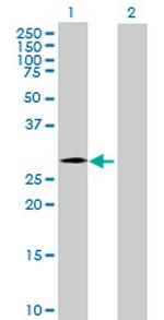 CHMP4C Antibody in Western Blot (WB)