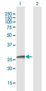 EGLN3 Antibody in Western Blot (WB)