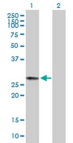 C6orf117 Antibody in Western Blot (WB)