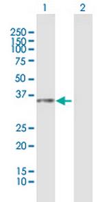 LOC112937 Antibody in Western Blot (WB)