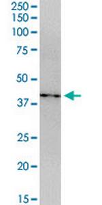 CDCA5 Antibody in Western Blot (WB)