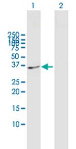 SDSL Antibody in Western Blot (WB)