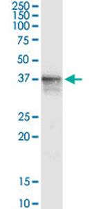 SDSL Antibody in Western Blot (WB)