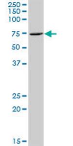 ZNF257 Antibody in Western Blot (WB)